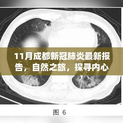 11月成都新冠肺炎最新报告,自然之旅,探寻内心的宁静与乐趣